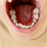【調査報告】歯列矯正経験者の8割以上が歯列矯正は想定していたよりも大変だった！その原因は？