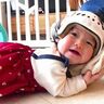 赤ちゃんの「向き癖」で気になる頭のかたち…専門治療できる外来が札幌に誕生