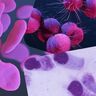 特効薬だったペニシリン「ほぼ100％効かない」性感染症拡大と薬剤耐性化の今