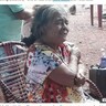 「56年前に妊娠か」石灰化した胎児を抱えた81歳女性、摘出翌日に死亡（ブラジル）