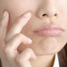 肌荒れの原因と対策は？漢方による処方例も【生薬と漢方薬の事典】
