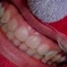 3歳児の〝怖すぎるイタズラ〟に16万人絶叫　まさかの場所に歯を付けて...「マジで声出た」「将来が恐ろしい」